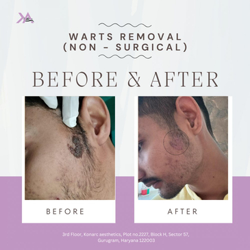 Slider image (7) Konarc Aesthetics - Plastic & Cosmetic Surgery In Gurgaon, India.